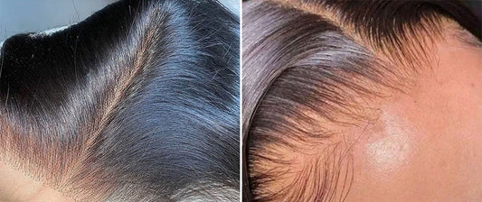 HD Lace Frontals